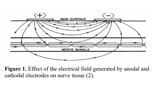 Correct Electrode Placement During Sham Stimulation in Transcutaneous ...