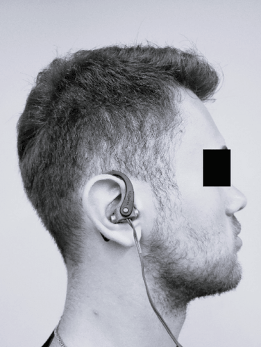 Effects of a single session of noninvasive auricular vagus nerve stimulation on sports performance in elite athletes: an open-label randomized controlled trial