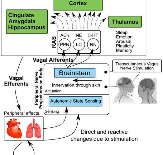 taVNS for PTSD: A Novel Approach to Symptom Relief and Recovery