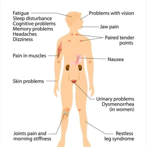 Vagus Nerve Stimulation: A New Hope for Fibromyalgia Relief