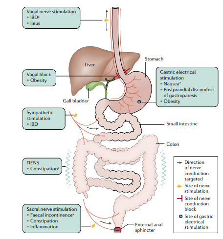 Vagus Nerve Stimulation: A Revolution in Gastrointestinal Health